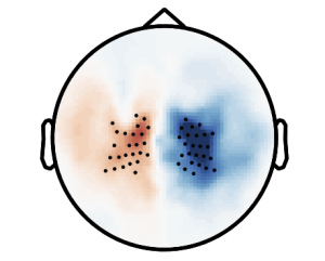If you can immediately see what contrast is shown here, you can proudly call yourself an electrophysiology nerd.
